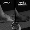 Baume Miracle - Soulagement Actif Jambes Lourdes et Douleurs
